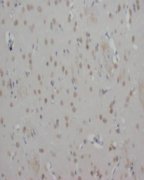 GAD1 / GAD67 Antibody -  This image was taken for the unconjugated form of this product. Other forms have not been tested.