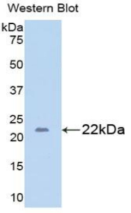 GAD65 Antibody - Western blot of recombinant GAD65.  This image was taken for the unconjugated form of this product. Other forms have not been tested.