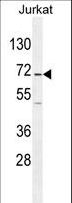 GAD65 Antibody - GAD2 Antibody western blot of Jurkat cell line lysates (35 ug/lane). The GAD2 antibody detected the GAD2 protein (arrow).