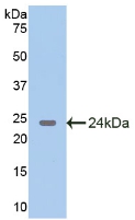 GAD65 Antibody - Western Blot; Sample: Recombinant GAD2, Rat.