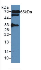 GAD65 Antibody - Western Blot; Sample: Rat Serum.