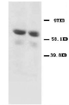 GAD65 Antibody - WB of GAD65 antibody. Lane 1: Rat Brain Tissue Lysate. Lane 2: Rat Brain Tissue Lysate.