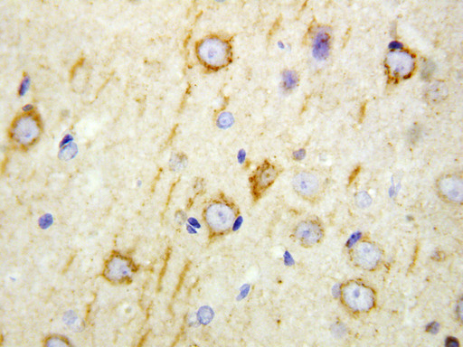 GAD65 Antibody - GAD65 antibody. IHC(P): Rat Brain Tissue.