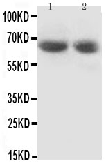 GAD65 Antibody - Anti-GAD65 antibody, Western blotting Lane 1: Rat Brain Tissue LysateLane 2: Rat Brain Tissue Lysate