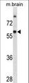 GAD65 Antibody - GAD2 Antibody western blot of mouse brain tissue lysates (35 ug/lane). The GAD2 antibody detected the GAD2 protein (arrow).