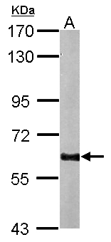 GAD65 Antibody - Sample (20 ug of whole cell lysate). A: mouse brain. 7.5% SDS PAGE. GAD65 antibody diluted at 1:10000.
