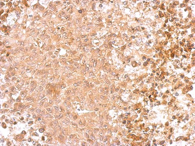 GAD65 Antibody - GAD65 antibody [C2C3], C-term detects GAD2 protein at cytosol on RT2 xenograft by immunohistochemical analysis. Sample: Paraffin-embedded RT2 xenograft. GAD65 antibody [C2C3], C-term dilution:1:500.