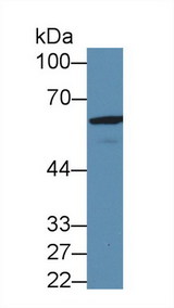 GAD65 Antibody - Western Blot; Sample: Mouse Cerebrum lysate; Primary Ab: 3µg/ml Rabbit Anti-Human GAD2 Antibody Second Ab: 0.2µg/mL HRP-Linked Caprine Anti-Rabbit IgG Polyclonal Antibody