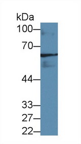 GAD65 Antibody - Western Blot; Sample: Rat Cerebrum lysate; Primary Ab: 3µg/ml Rabbit Anti-Human GAD2 Antibody Second Ab: 0.2µg/mL HRP-Linked Caprine Anti-Rabbit IgG Polyclonal Antibody (Catalog: SAA544Rb19