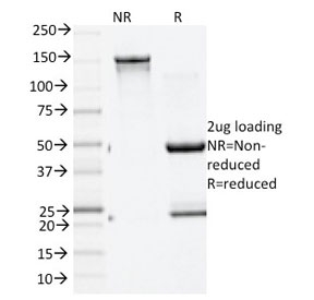 GAD65 Antibody - SDS-PAGE analysis of purified, BSA-free GAD65 antibody (clone GAD2/1960) as confirmation of integrity and purity.