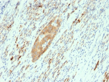 GAD65 Antibody - IHC testing of FFPE human pancreas with GAD65 antibody (clone GAD2/2362). Required HIER: boil tissue sections in 10mM citrate buffer, pH 6, for 10-20 min and allow to cool prior to testing.