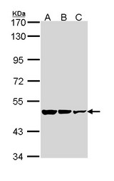 GAD65 Antibody - Sample (30 ug of whole cell lysate). A: A431. B: H1299. C: Hela. 7.5% SDS PAGE. GAD2 antibody diluted at 1:1000. 