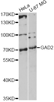 GAD65 Antibody - Western blot analysis of extracts of various cell lines, using GAD2 antibody at 1:1000 dilution. The secondary antibody used was an HRP Goat Anti-Rabbit IgG (H+L) at 1:10000 dilution. Lysates were loaded 25ug per lane and 3% nonfat dry milk in TBST was used for blocking. An ECL Kit was used for detection and the exposure time was 90s.