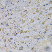 GAD65 Antibody - Immunohistochemistry of paraffin-embedded rat brain using GAD2 Antibodyat dilution of 1:100 (40x lens).