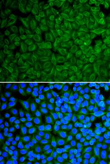 GAD65 Antibody - Immunofluorescence analysis of HeLa cells using GAD2 antibody. Blue: DAPI for nuclear staining.