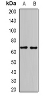 GAD65 Antibody - Western blot analysis of GAD2 expression in mouse heart (A); mouse brain (B) whole cell lysates.