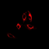 GAD65 Antibody - Immunofluorescent analysis of GAD2 staining in A549 cells. Formalin-fixed cells were permeabilized with 0.1% Triton X-100 in TBS for 5-10 minutes and blocked with 3% BSA-PBS for 30 minutes at room temperature. Cells were probed with the primary antibody in 3% BSA-PBS and incubated overnight at 4 deg C in a humidified chamber. Cells were washed with PBST and incubated with a DyLight 594-conjugated secondary antibody (red) in PBS at room temperature in the dark.