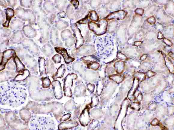 GAD65 Antibody - GAD65 was detected in paraffin-embedded sections of rat kidney tissues using rabbit anti-GAD65 Antigen Affinity purified polyclonal antibody (Catalog #) at 1 µg/mL. The immunohistochemical section was developed using SABC method