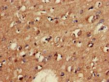 GAD65 Antibody - Immunohistochemistry of paraffin-embedded human brain tissue at dilution of 1:100