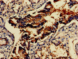 GAD65 Antibody - Immunohistochemistry of paraffin-embedded human lung tissue at dilution of 1:100