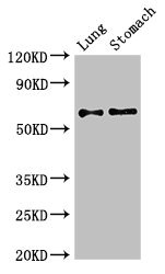 GAD65 Antibody - Western Blot Positive WB detected in:Mouse lung tissue,Mouse stomach tissue All Lanes:GAD2 antibody at 2.7µg/ml Secondary Goat polyclonal to rabbit IgG at 1/50000 dilution Predicted band size: 66 KDa Observed band size: 66 KDa