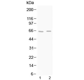 GAD65 Antibody - Western blot testing of 1) rat brain and 2) mouse brain lysate with GAD65 antibody at 0.5ug/ml. Predicted molecular weight ~65 kDa.