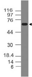 GAD65 Antibody - Fig-1: Western blot analysis of GAD65. Anti-GAD65 antibody was used at 2 µg/ml on h Pancrease lysate.