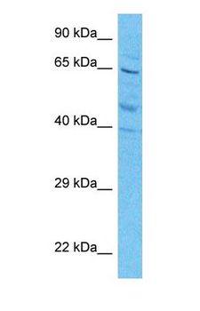 GAD65 Antibody - Western blot of DCE2 Antibody with human HepG2 Whole Cell lysate.  This image was taken for the unconjugated form of this product. Other forms have not been tested.