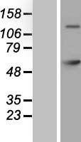 GAD65 Protein - Western validation with an anti-DDK antibody * L: Control HEK293 lysate R: Over-expression lysate