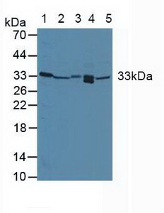 GADD45A / GADD45 Antibody - Western Blot; Lane1: Human Placenta Tissue; Lane2: Mouse Liver Tissue; Lane3: Mouse Kidney Tissue; Lane4: Mouse Lung Tissue; Lane5: Mouse Spleen Tissue.
