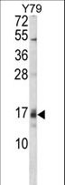 GADD45A / GADD45 Antibody - Western blot of GADD45A Antibody in Y79 cell line lysates (35 ug/lane). GADD45A (arrow) was detected using the purified antibody.