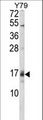 GADD45A / GADD45 Antibody - Western blot of GADD45A Antibody in Y79 cell line lysates (35 ug/lane). GADD45A (arrow) was detected using the purified antibody.