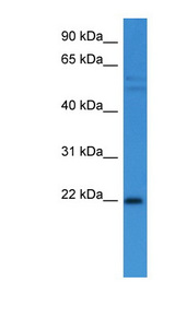 GADD45A / GADD45 Antibody - GADD45A antibody Western blot of Fetal Heart lysate.  This image was taken for the unconjugated form of this product. Other forms have not been tested.
