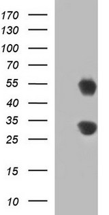 GADD45A / GADD45 Antibody - HEK293T cells were transfected with the pCMV6-ENTRY control (Left lane) or pCMV6-ENTRY GADD45A (Right lane) cDNA for 48 hrs and lysed. Equivalent amounts of cell lysates (5 ug per lane) were separated by SDS-PAGE and immunoblotted with anti-GADD45A.