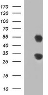 GADD45A / GADD45 Antibody - HEK293T cells were transfected with the pCMV6-ENTRY control (Left lane) or pCMV6-ENTRY GADD45A (Right lane) cDNA for 48 hrs and lysed. Equivalent amounts of cell lysates (5 ug per lane) were separated by SDS-PAGE and immunoblotted with anti-GADD45A.