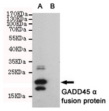 GADD45A / GADD45 Antibody - Western blot detection of GADD45 alpha in CHO-K1 cell lysate ( B ) and CHO-K1 transfected by GADD45 alpha His fusion protein ( A ) cell lysate using GADD45 alpha mouse monoclonal antibody (1:1000 dilution). Predicted band size: 22KDa. Observed band size:22KDa.