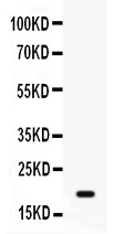 GADD45A / GADD45 Antibody - Western blot - Anti-GADD45A/Gadd 45Alpha Picoband Antibody