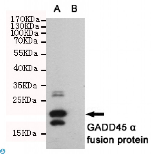 GADD45A / GADD45 Antibody - Western blot detection of GADD45 a in CHO-K1 cell lysate (B) and CHO-K1 transfected by GADD45 a His fusion protein (A) cell lysate using GADD45 a mouse mAb (1:1000 diluted). Predicted band size: 22KDa. Observed band size: 22KDa.
