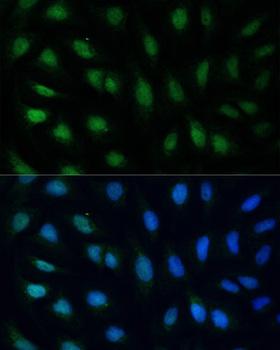 GADD45A / GADD45 Antibody - Immunofluorescence analysis of U2OS cells using GADD45A Polyclonal Antibody at dilution of 1:100.Blue: DAPI for nuclear staining.