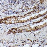 GADD45A / GADD45 Antibody - Immunohistochemistry of paraffin-embedded Rat lung using GADD45A Polyclonal Antibody at dilution of 1:100 (40x lens).