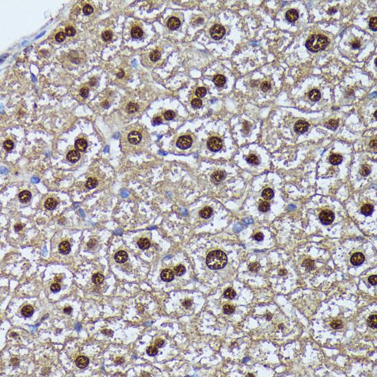 GADD45A / GADD45 Antibody - Immunohistochemistry of paraffin-embedded Mouse liver using GADD45A Polyclonal Antibody at dilution of 1:100 (40x lens).