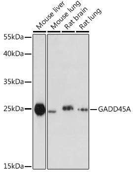 GADD45A / GADD45 Antibody - Western blot analysis of extracts of various cell lines using GADD45A Polyclonal Antibody at dilution of 1:1000.