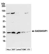 GADD45GIP1 / CRIF1 Antibody - Detection of human and mouse GADD45GIP1 by western blot. Samples: Whole cell lysate (50 µg) from HeLa, HEK293T, Jurkat, mouse TCMK-1, and mouse NIH 3T3 cells prepared using NETN lysis buffer. Antibody: Affinity purified rabbit anti-GADD45GIP1 antibody used for WB at 0.1 µg/ml. Detection: Chemiluminescence with an exposure time of 10 seconds.