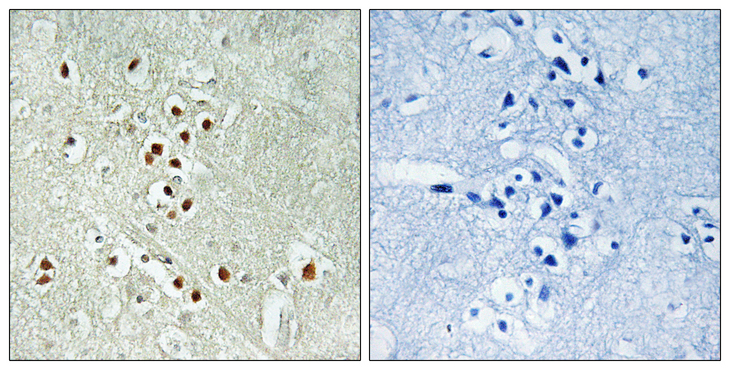 GADD45GIP1 / CRIF1 Antibody - Immunohistochemistry analysis of paraffin-embedded human brain, using GADD45GIP1 Antibody. The picture on the right is blocked with the synthesized peptide.