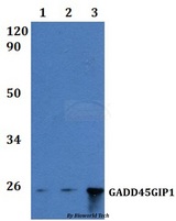 GADD45GIP1 / CRIF1 Antibody - Western blot of GADD45GIP1 antibody at 1:500 dilution Line1:HeLa whole cell lysate Line2:PC12 whole cell lysate Line3:sp20 whole cell lysate.