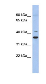 GADL1 Antibody - GADL1 antibody Western blot of Fetal Heart lysate. This image was taken for the unconjugated form of this product. Other forms have not been tested.