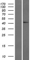 GADL1 Protein - Western validation with an anti-DDK antibody * L: Control HEK293 lysate R: Over-expression lysate