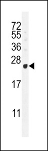 GAGE12B Antibody - GAGE12B Antibody western blot of T47D cell line lysates (35 ug/lane). The GAGE12B antibody detected the GAGE12B protein (arrow).