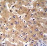 GAGE12B Antibody - GAGE12B Antibody immunohistochemistry of formalin-fixed and paraffin-embedded human liver tissue followed by peroxidase-conjugated secondary antibody and DAB staining.