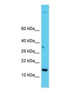 GAGE12I / GAGE7B Antibody - Western blot of GAGE12I Antibody - C-terminal region with human PANC1 cells lysate.  This image was taken for the unconjugated form of this product. Other forms have not been tested.
